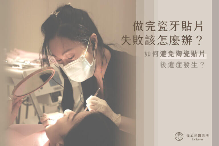 瓷牙貼片失敗怎麼辦？常見的瓷牙貼片後悔、掉落原因全解析！