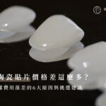 牙齒陶瓷貼片價格差這麼多？