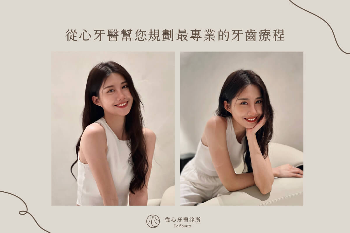 SEO 牙齒變黃怎麼辦？透過5種牙齒美白方法，讓你重拾自信笑容！ 案例