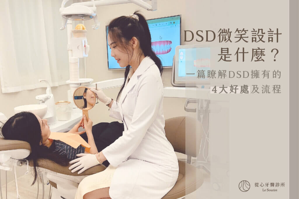 SEO DSD微笑設計是什麼？一篇瞭解DSD擁有的4大好處及流程 工作區域 1