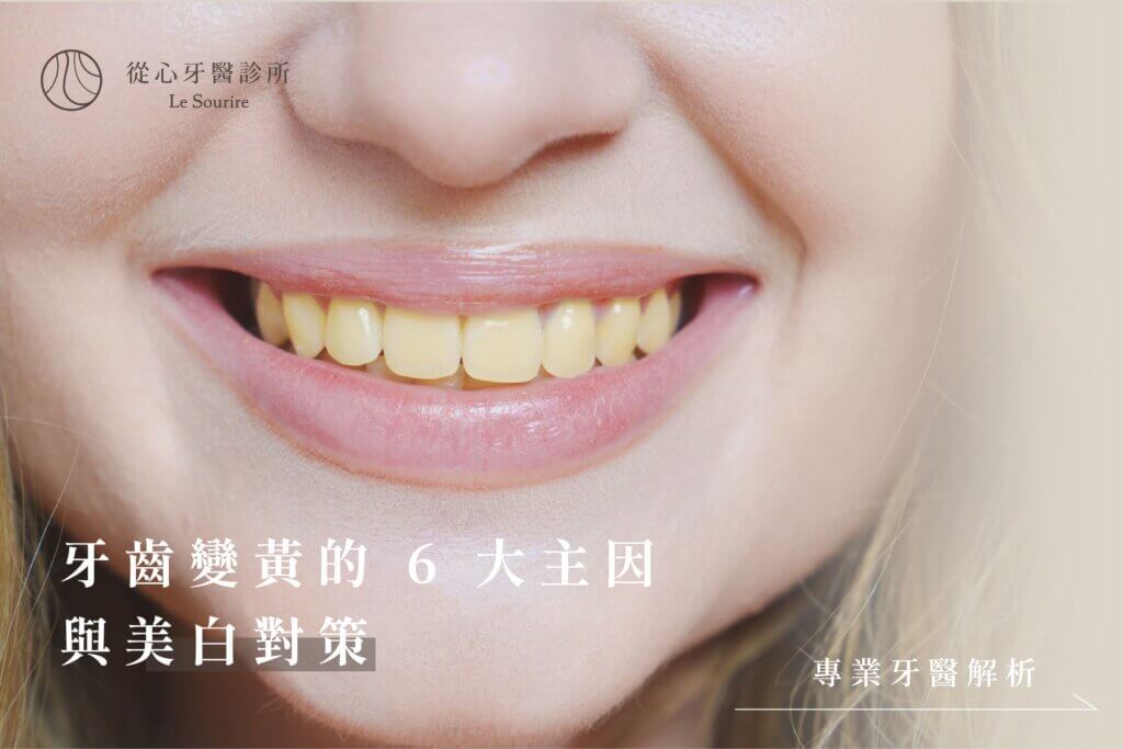 牙齒變黃的 6 大主因與美白對策｜專業牙醫解析