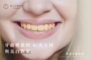牙齒變黃的 6 大主因與美白對策｜專業牙醫解析