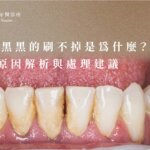 官網 牙齒變黑 04