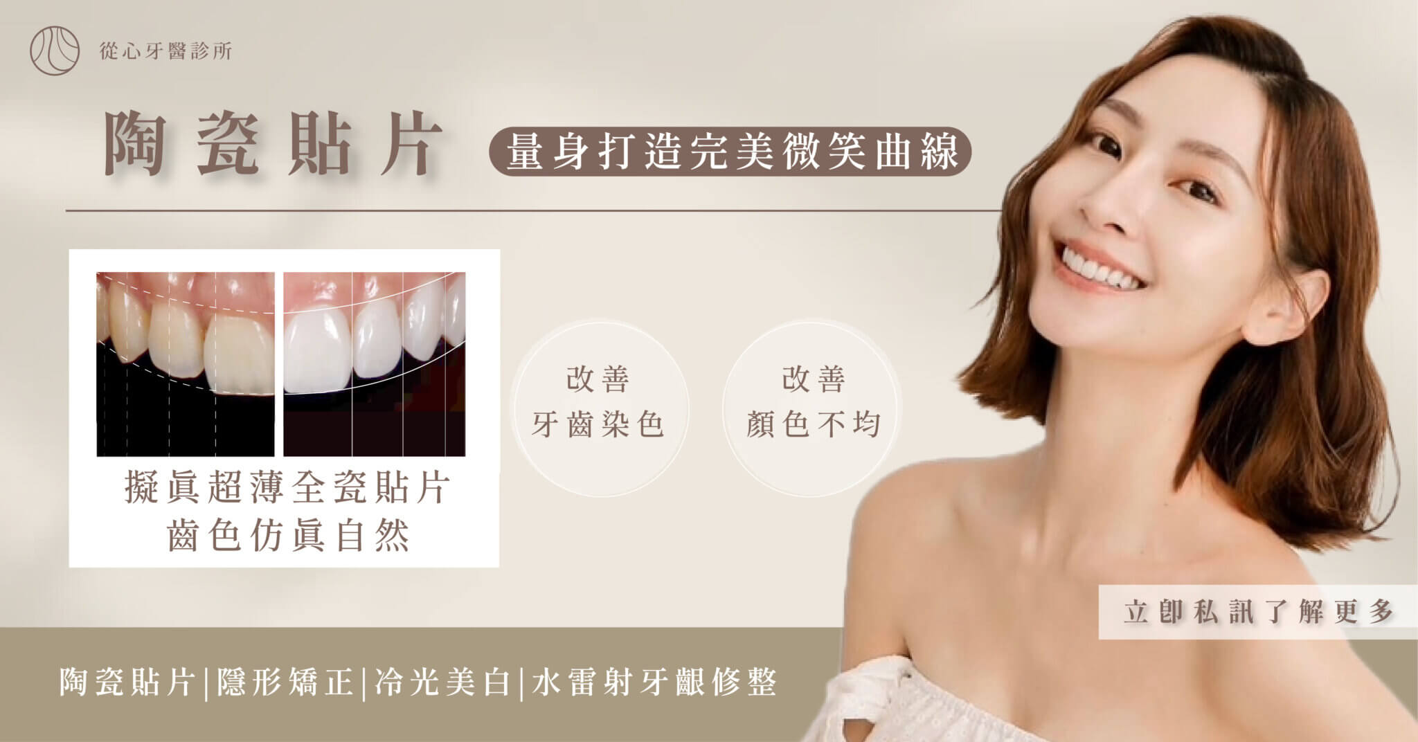 陶瓷貼片怎麼打造明星級笑容？3大設計關鍵全面解析（形狀、微笑曲線、牙齒比例）