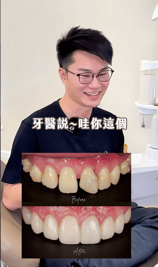 牙齒做失敗後的重生！連國外團隊都稱讚的牙齒｜陶瓷貼片案例分享