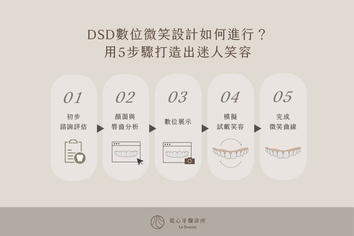 SEO-DSD微笑設計是什麼？一篇瞭解DSD擁有的4大好處及流程_5步驟迷人笑容