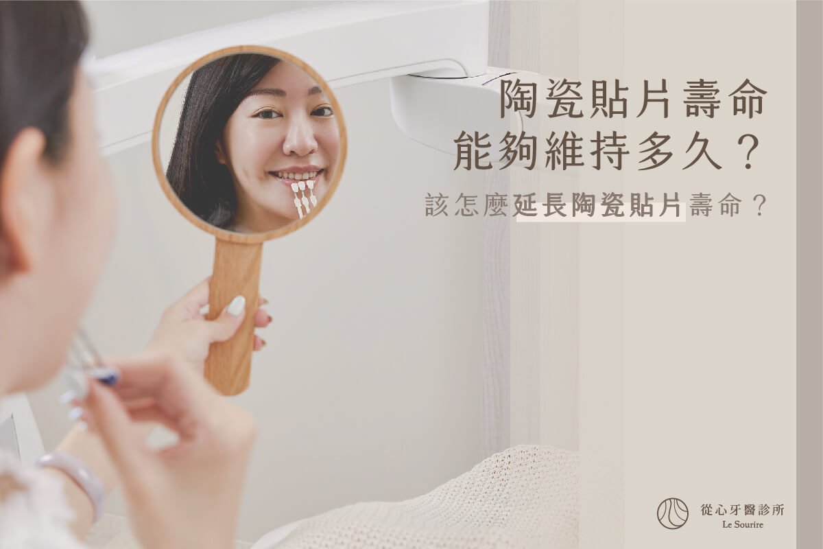 SEO-陶瓷貼片壽命能維持多久_封面 SEO-陶瓷貼片壽命能維持多久_封面
